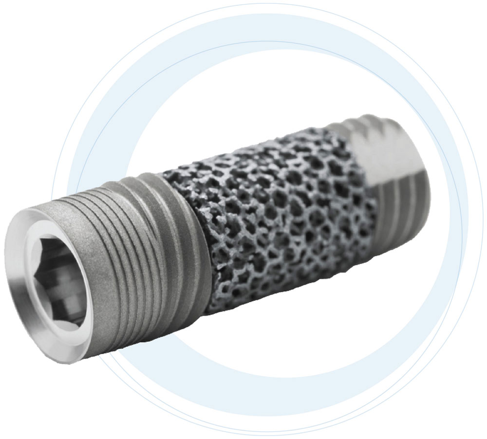 Trabecular Metal