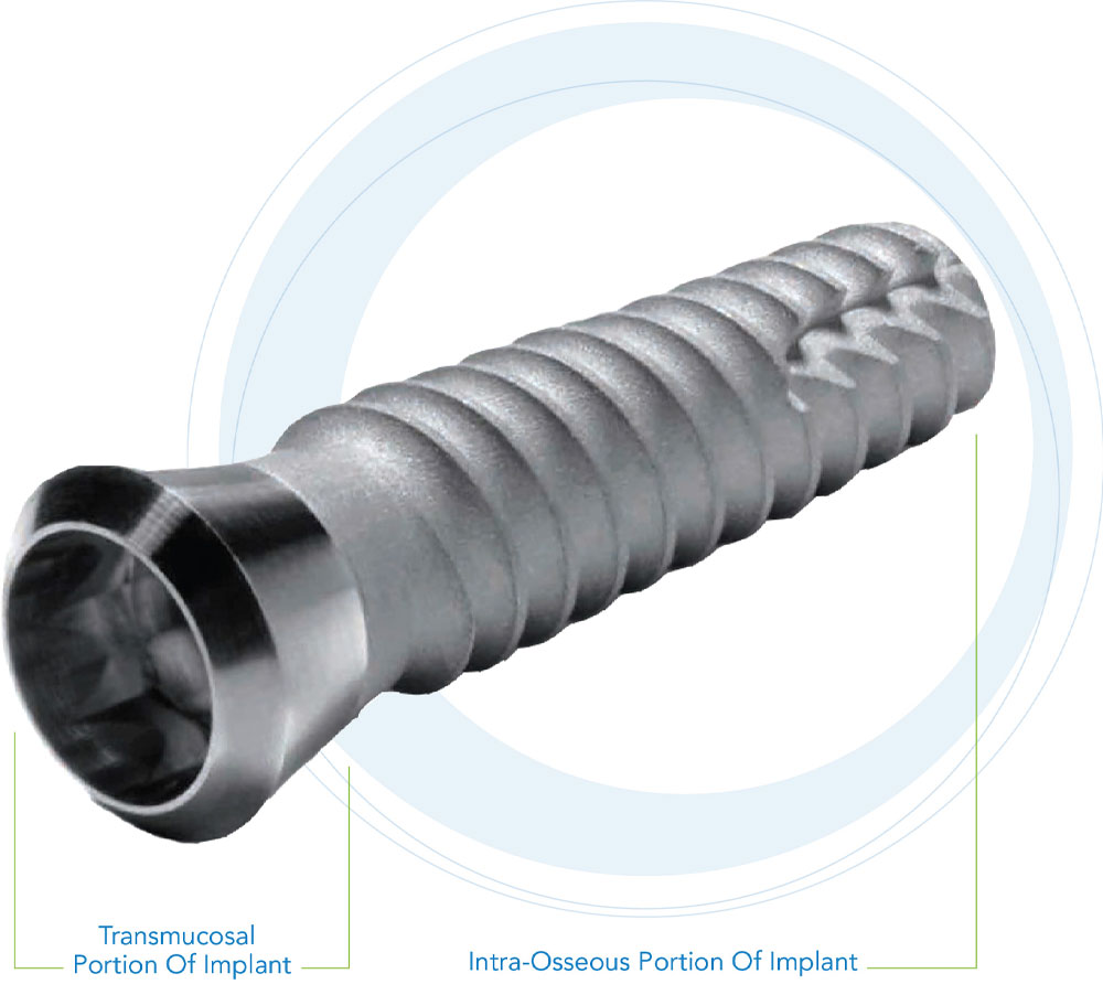Swiss Plus Implant